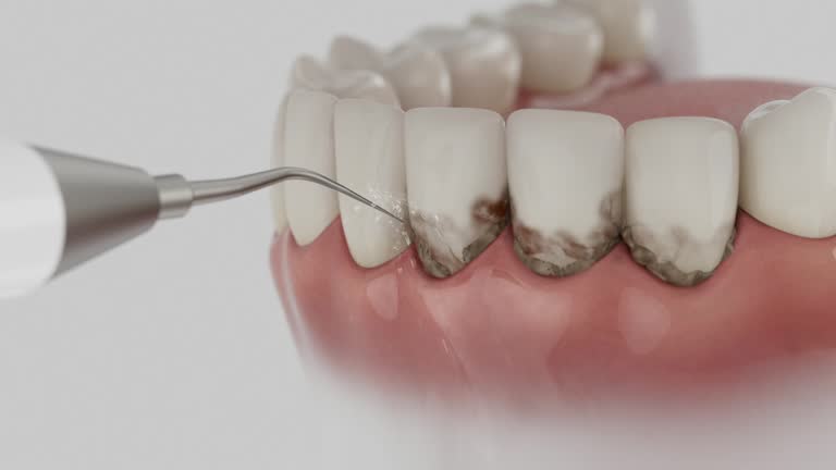 Trusted Tooth Extraction service in Indiana, PA - Dentist Open Now